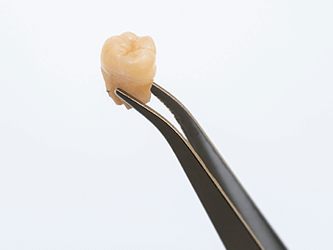 tooth extraction dentist