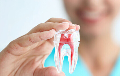 Root Canal Treatment