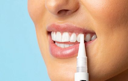 Teeth Whitening