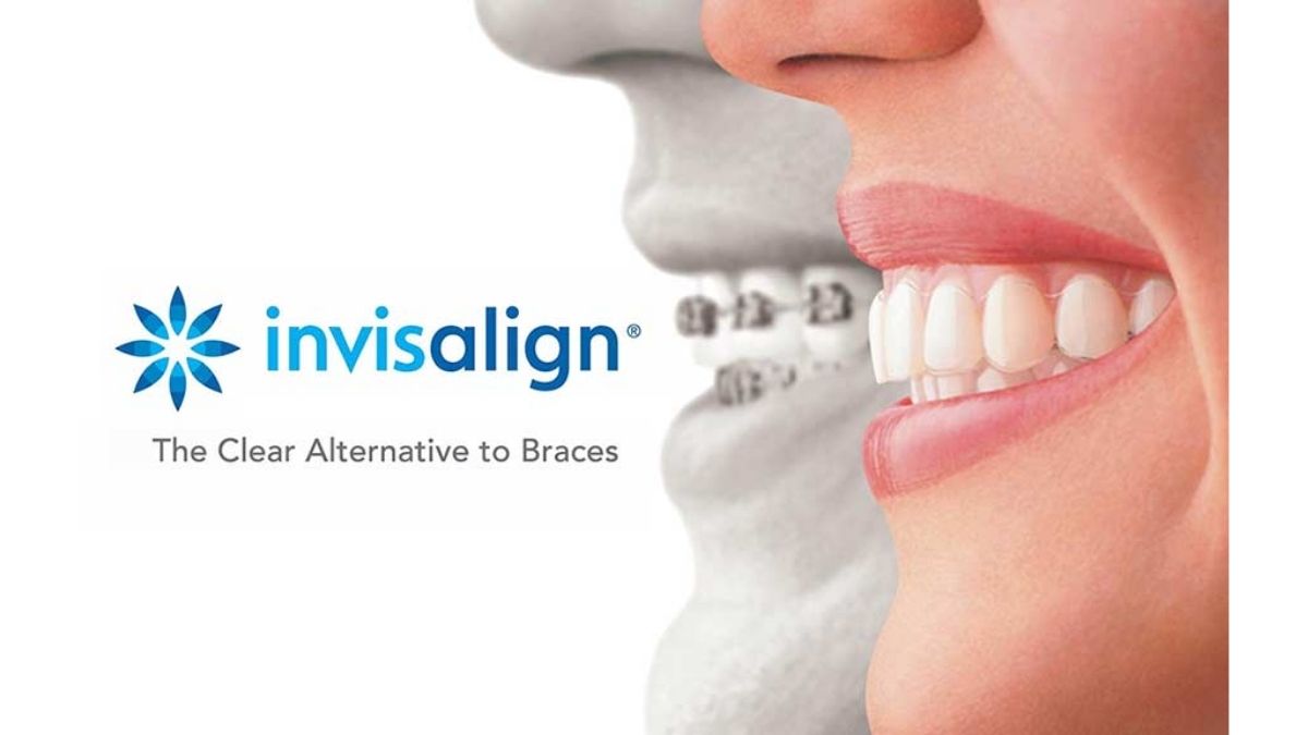 Invisalign