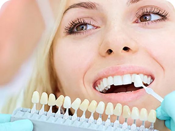 Porcelain Veneers